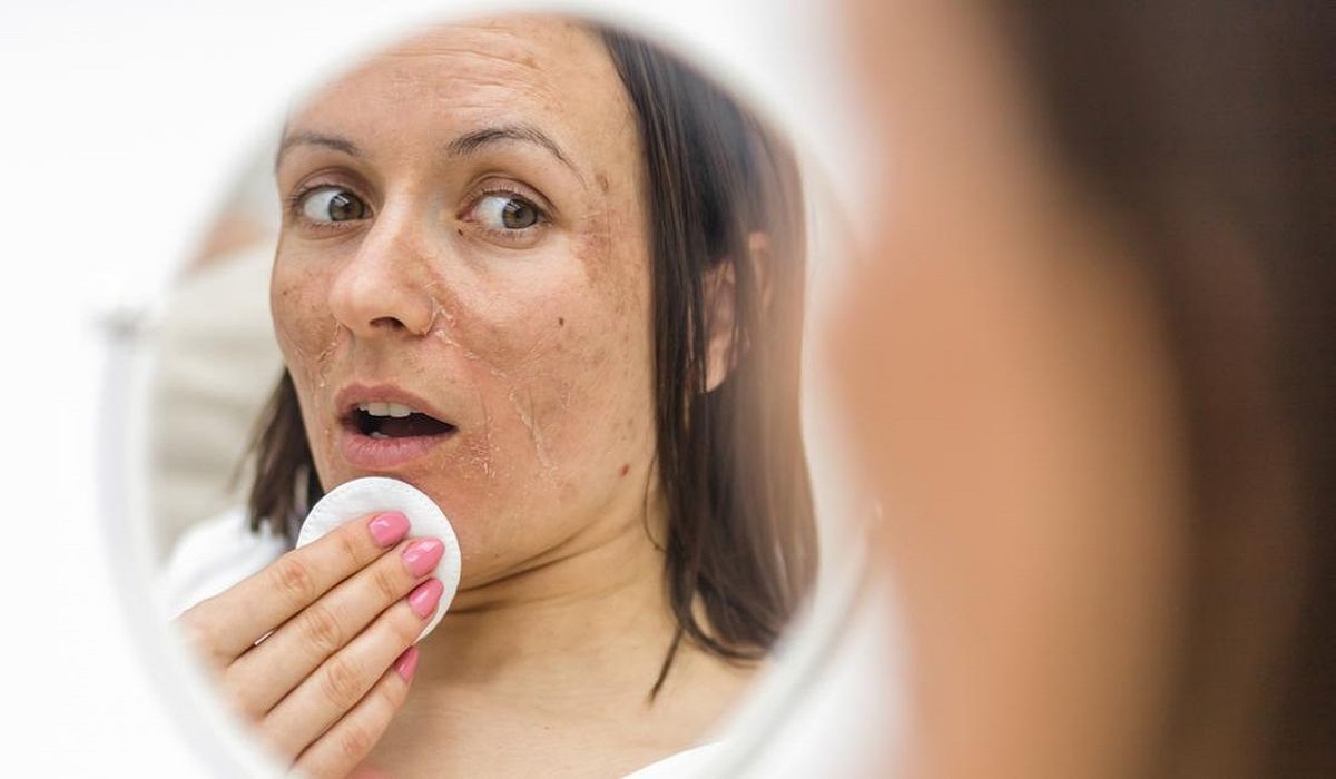 Kosmetik yang Menyebabkan Flek Hitam